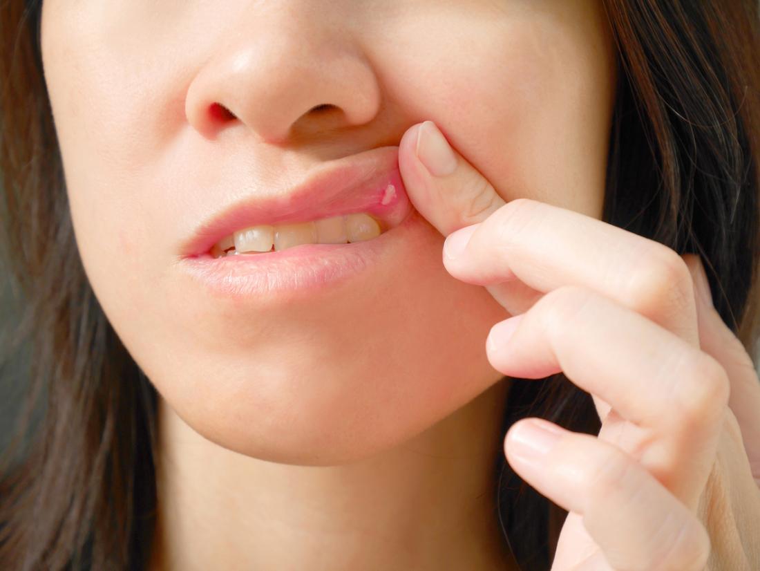 Oral Pathology Oral Pathology