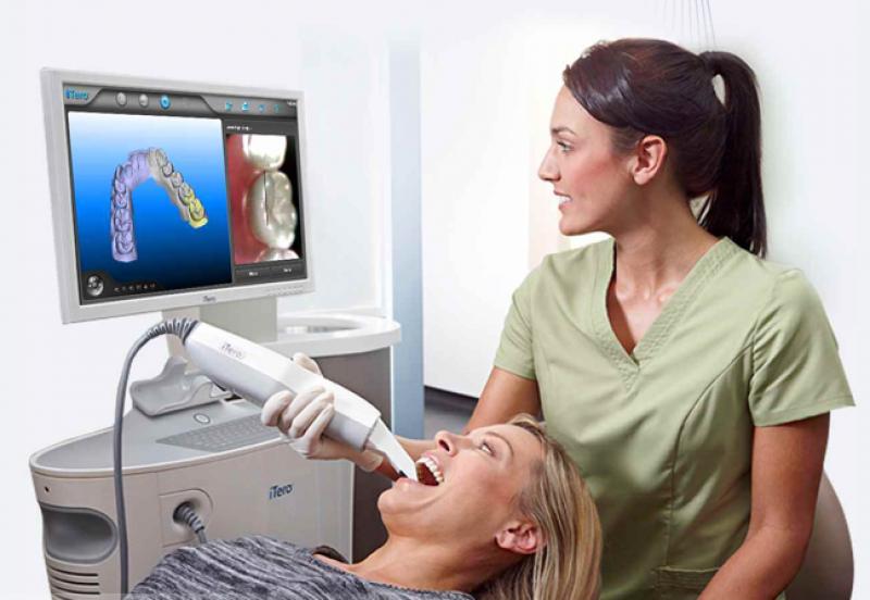 iTero Scanner iTero Scanner