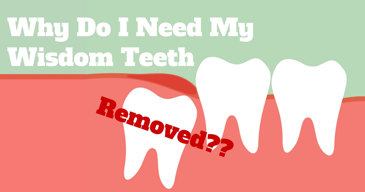Wisdom Teeth FAQ Wisdom Teeth FAQ