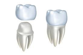 Periodontal disease Bone Regeneration Periodontal disease Bone Regeneration